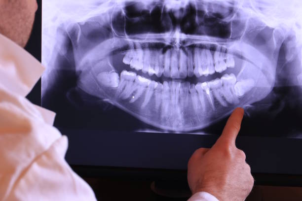 Best Pediatric Emergency Dentist in Rockville, MN
