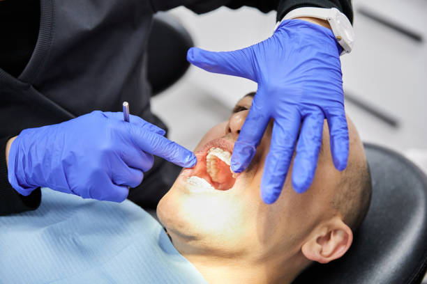 Best Emergency Broken Tooth Repair in Rockville, MN